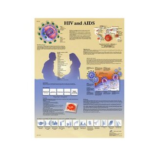 AIDS ja HIV -juliste