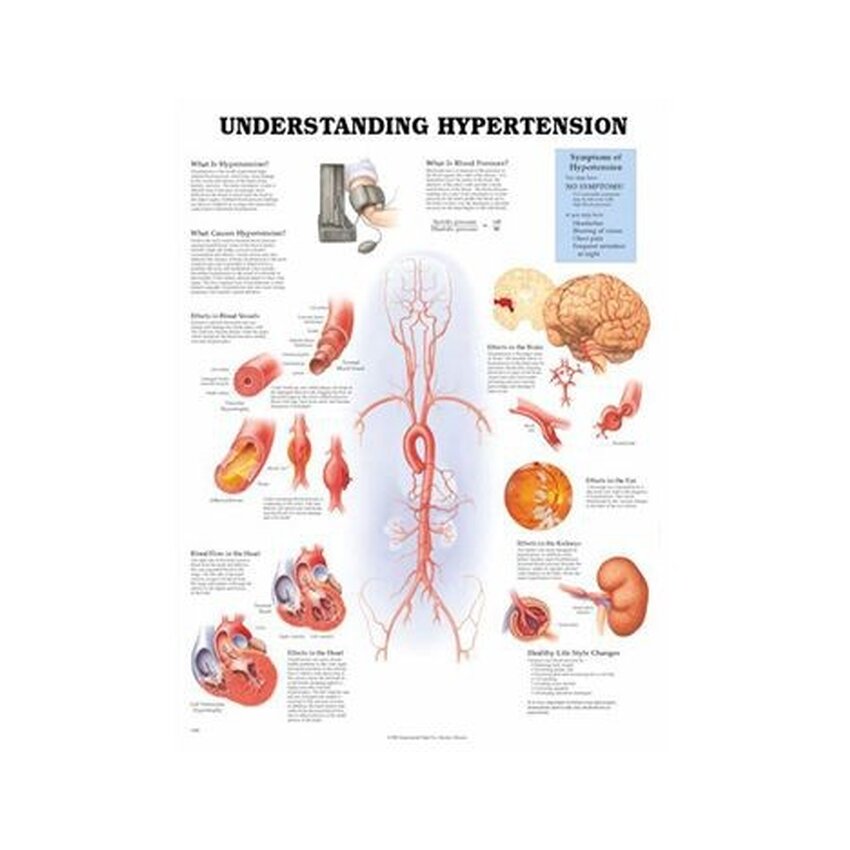 Understanding High Blood Pressure -laminoitu juliste 51x66 cm