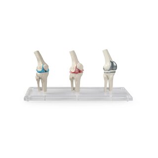 Polvi-implanttimalli